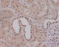 Anti-Smad1 Rabbit Monoclonal Antibody